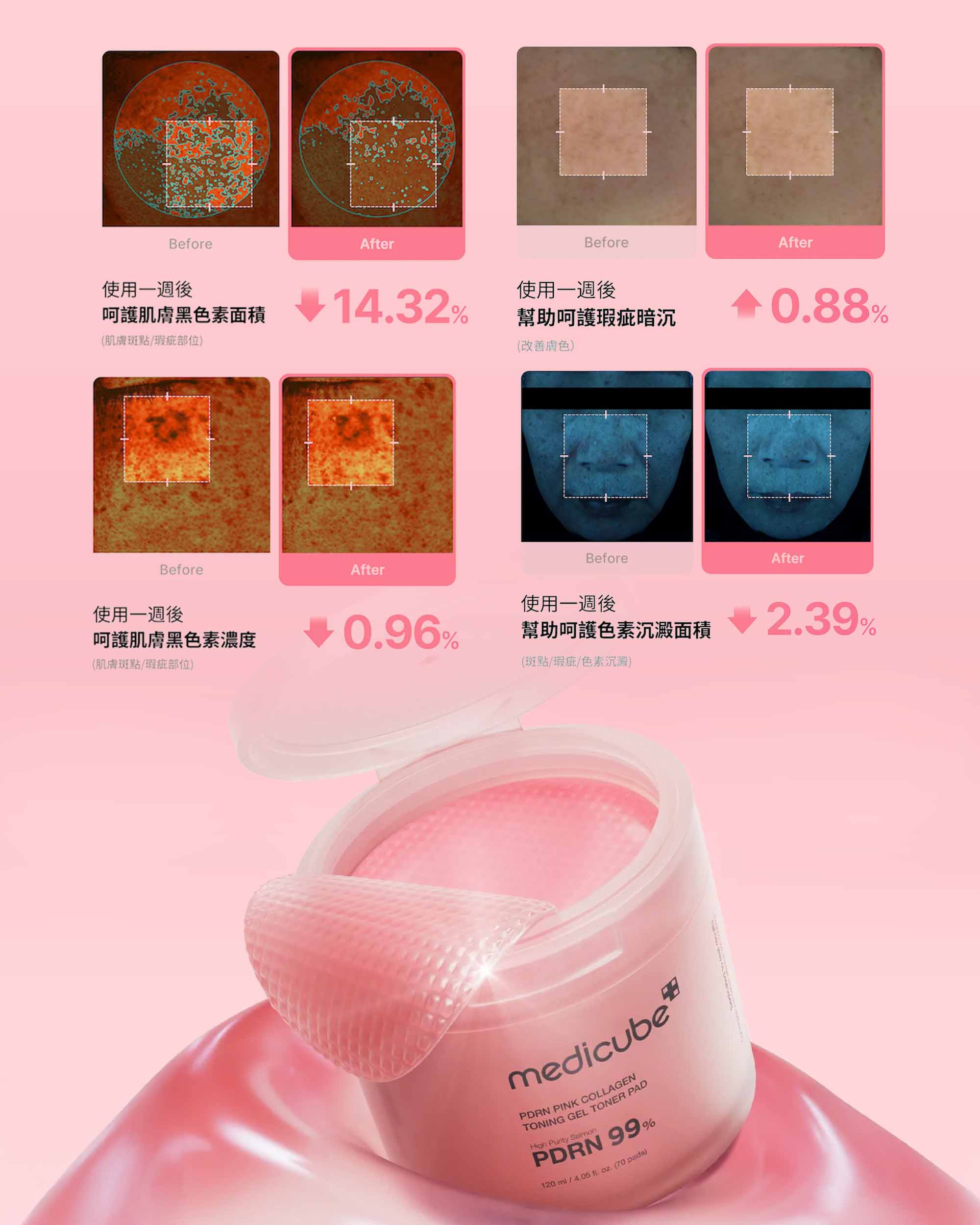 PDRN粉紅膠原凝膠爽膚棉 70P