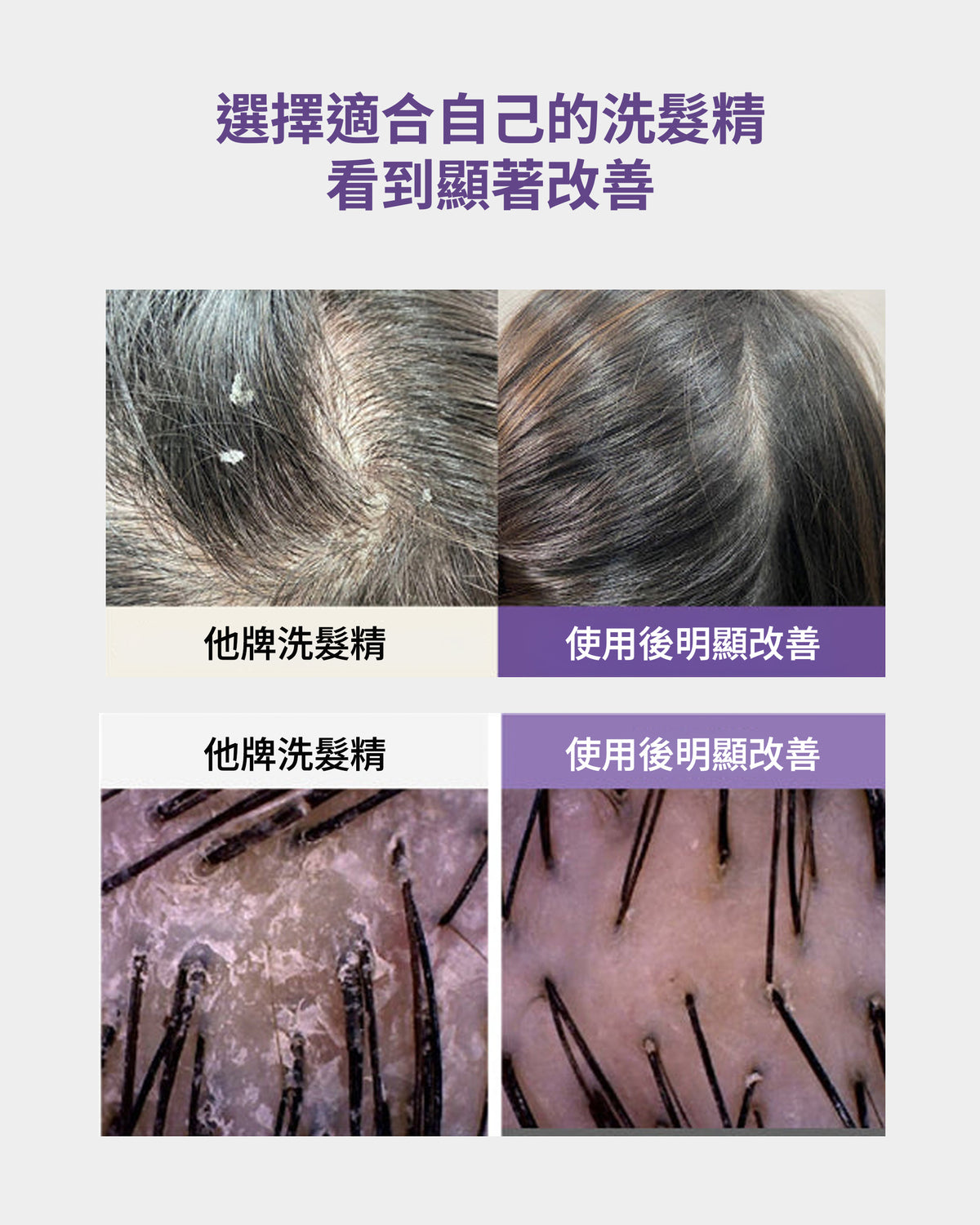 去屑止癢洗髮精 500ml
