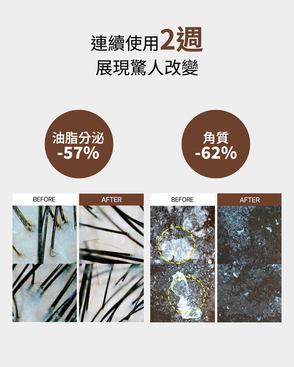 微生態平衡蘊髮洗髮精 500ml